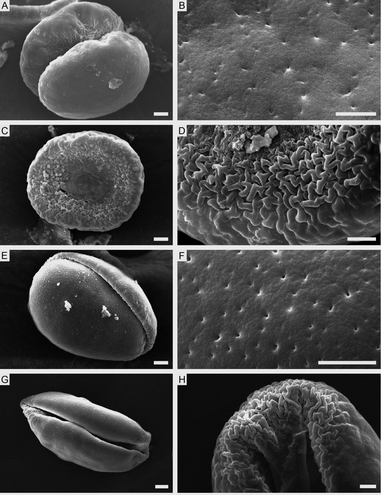 花粉的形狀和外壁紋飾 中國風(fēng)景園林網(wǎng)